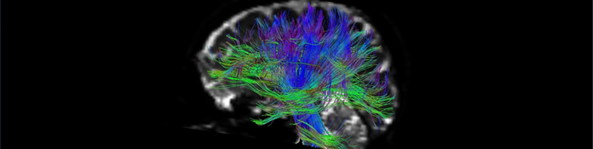 https://www.idival.org/wp-content/uploads/2022/07/BannerNeuroimagen.jpg